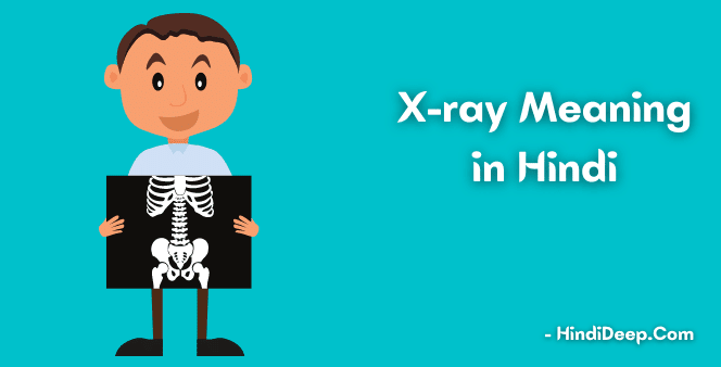 X-ray-Meaning-in-Hindi